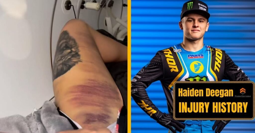 Haiden Deegan Injury